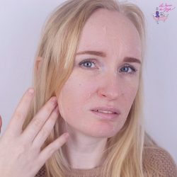 Au secours, j'ai une peau de croco ! Les soins à prodiguer